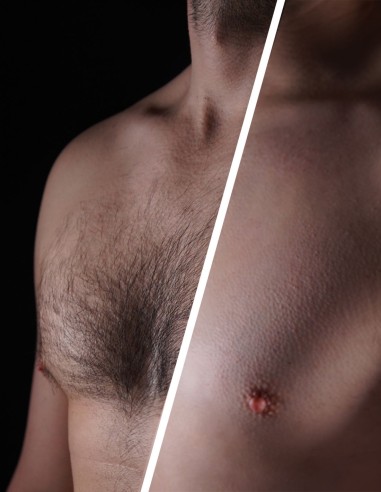 Crema Depilatoria Uomo per corpo e Zone Intime